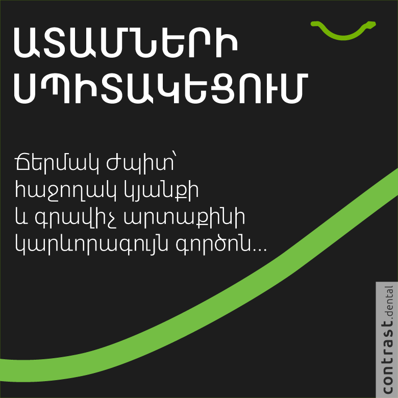 Ատամների սպիտակեցում