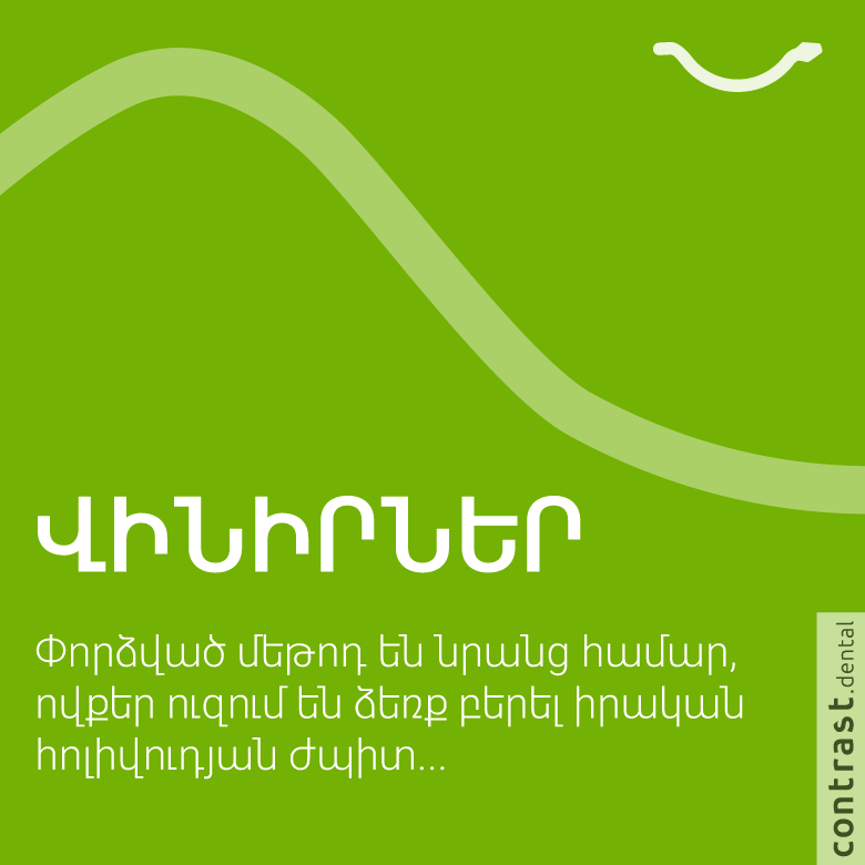 Վինիր կամ հոլիվուդյան ժպիտ