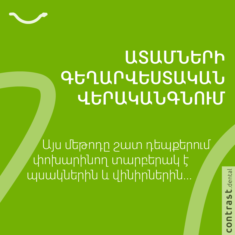 Ատամի պլոմբավորում